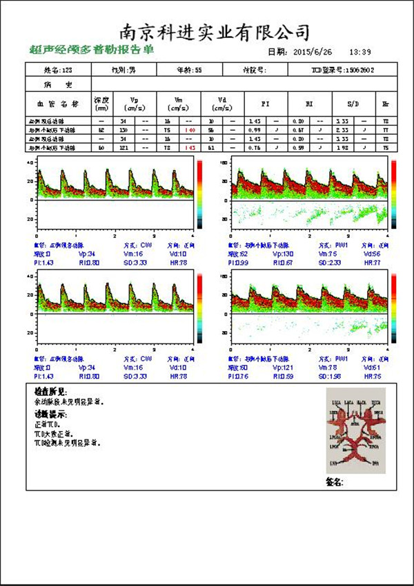 经颅多普勒报告图.jpg